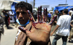رصد تحرکات نظامیان سعودی توسط رزمندگان یمنی + فیلم