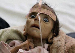 مرگ تدریجی میلیون‌ها یمنی زیر دست آمریکا، انگلیس و عربستان + فیلم