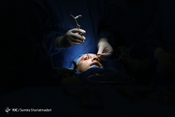 نخستین عمل جراحی بازسازی کامل صورت