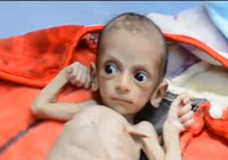 هر 10 دقیقه یک کودک یمنی می‌میرد!/ آماری تاسف بار از وضعیت کنونی یمن + فیلم