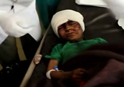 هلاکت ۱۴۰ متجاوز سعودی در یمن + فیلم