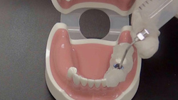 مراحل و نحوه عملکرد ایمپلنت دندان + فیلم