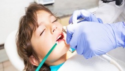 عوارض کشیدن دندان در کودکی + فیلم