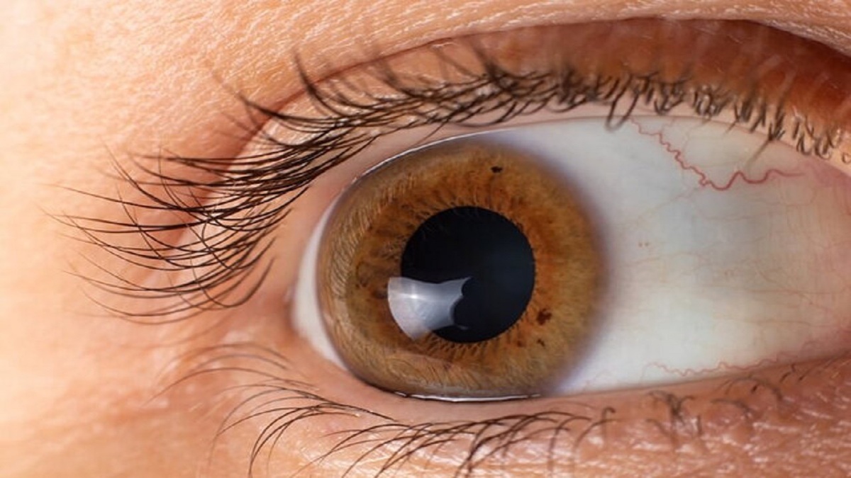بیماری بیرون‌زدگی چشم چیست؟ + فیلم