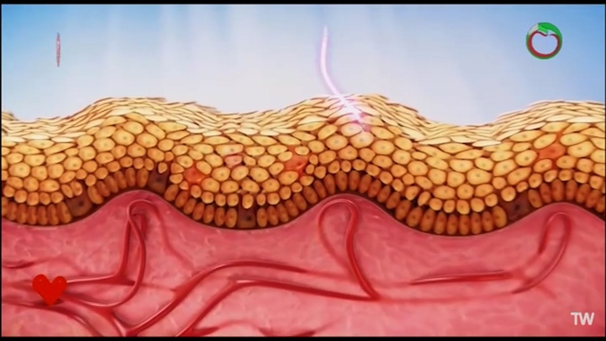 آنچه از نگاه طب سنتی به سرطان باید بدانید + فیلم